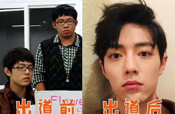 肖战出道前后对比